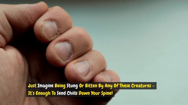 The DEADLIEST Venom in Nature Will SHOCK You - Don't Miss This! смотреть онлайн