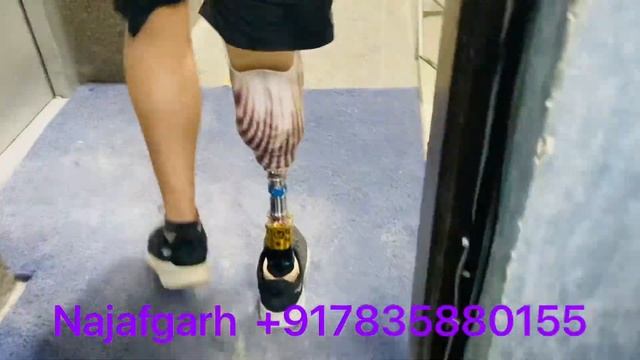 07835880155 - 113 kg weight leg lost | soleus foot | active prosthesis user | from Najafgarh | смотреть онлайн