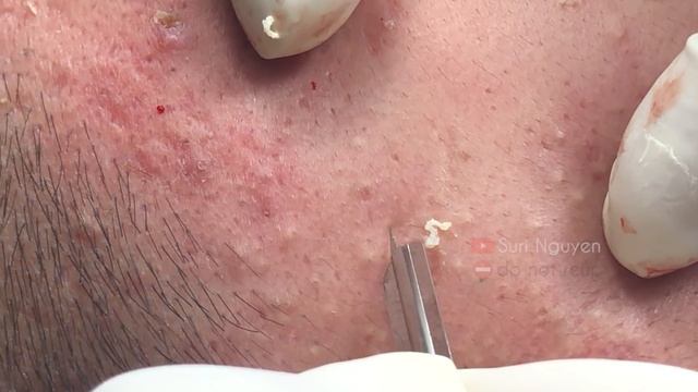 Satisfying And Relaxation With SURI NGUYEN Beauty Spa Video #430