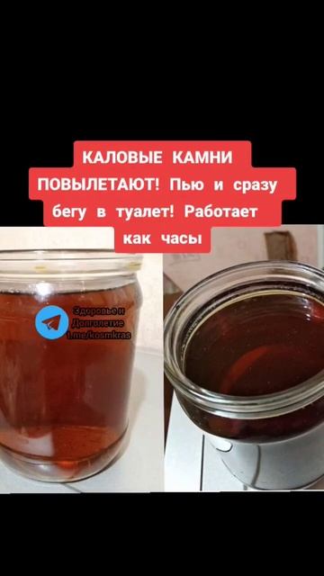 каловые камни ПОВЫЛЕТАЮТ пью и сразу бегу в туалет #народнаямедицина #здоровье #зож #долголетие смотреть онлайн