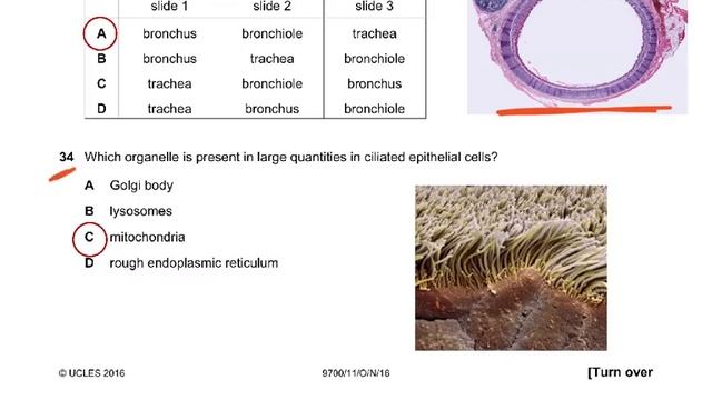 9700 A LEVEL BIOLOGY MCQ PAPER смотреть онлайн