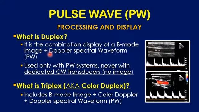 Doppler Waveform   A