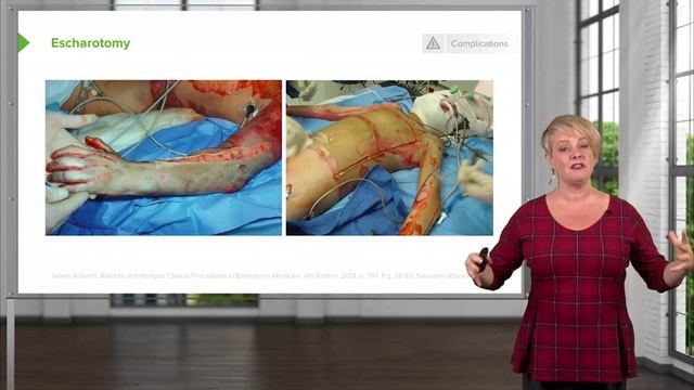 1.07 Circumferential Burns & Cyanide Poisoning смотреть онлайн