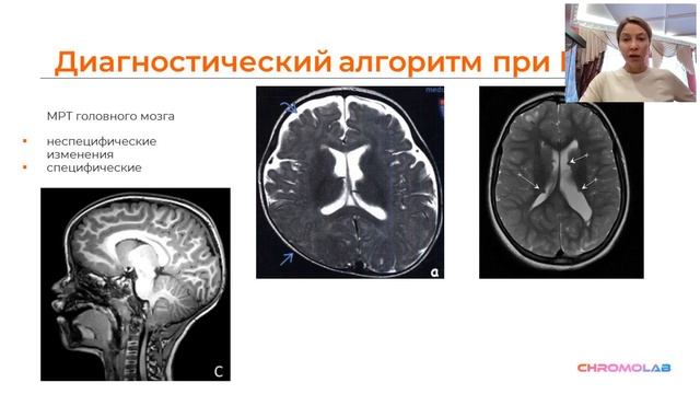 Алгоритм диагностики нарушений развития детей - практическое применение. Клинический случай смотреть онлайн