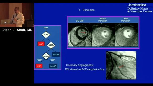 Stress MRI: Methodology, Current Role and Case Studies (Dipan Shah, MD) December 13, 2016 смотреть онлайн