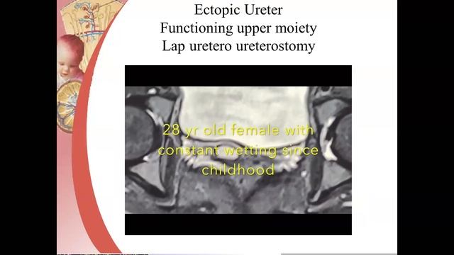 Approach to a wet child webinar by Dr Ramesh Babu смотреть онлайн