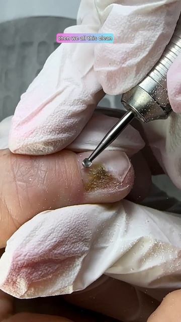 КАК ВЫЛЕЧИТЬ ЗЕЛЕНЫЙ НОГОТЬ? HOW TO CURE GREEN NAILS? #shortsvideo #nails #маникюр #ногти #гельлак смотреть онлайн