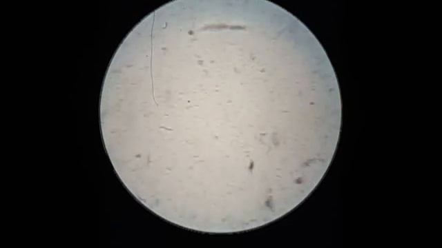 Enterobius vermicularis-Huevo смотреть онлайн