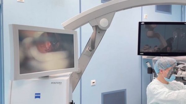 Как проводится операция на голосовых складках?