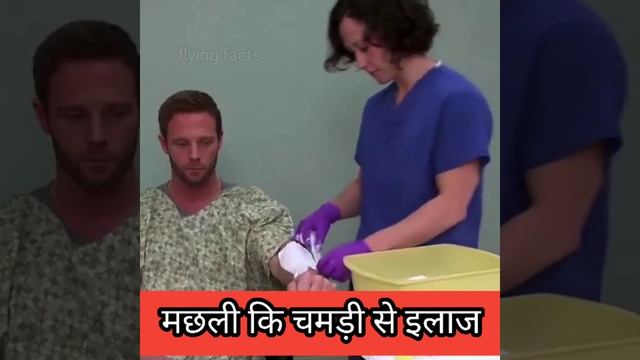 अद्भुत विज्ञान का करिश्मा।😯😲🤔🔥 मछली से इलाज #shorts #viral #facts #shorts #invention смотреть онлайн