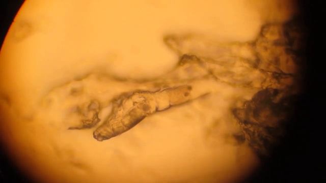 Demodicosis canis смотреть онлайн