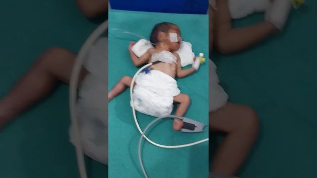 Preterm baby boy with 1 kg weight | #cute #viral #viralvideo #doctor #medical #shorts смотреть онлайн