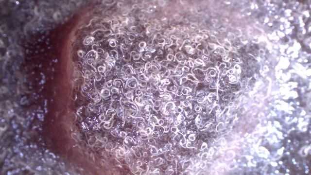 Pelodera strongyloides subculture on blood agar plate (day 12) смотреть онлайн