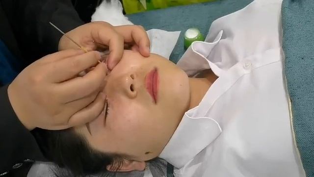Eye cleaning chinese/Eye spa/目の掃除/눈 청소【Eye ASMR】 смотреть онлайн