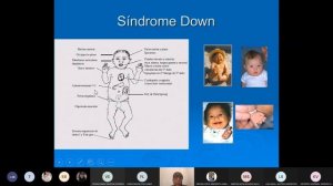SEMIOLOGÍA DE MALFORMACIONES DISMÓRFICAS - PEDIATRÍA