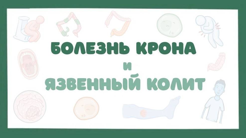 Болезнь Крона, Язвенный колит - причины, симптомы, лечение (лекция) смотреть онлайн