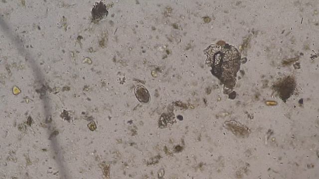 Hookworm egg in an unstained wet mount смотреть онлайн