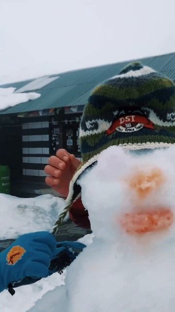 Путешествие вместе с САБАЙ. Непал. Рождение Гидроцефала.