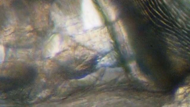 Daphnia pulex Internal Circulation 5 смотреть онлайн