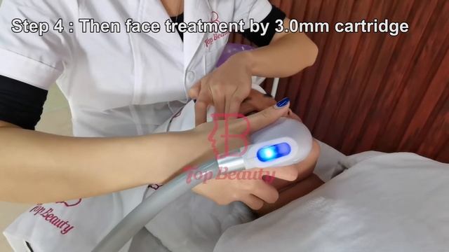 TB-HF01V 5D ice HIFU face lifting wrinkle removal machine смотреть онлайн