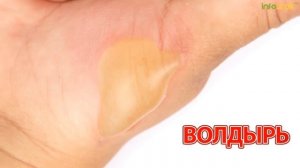 Детский травматизм   Классные часы и ОБЖ #26   Инфоурок