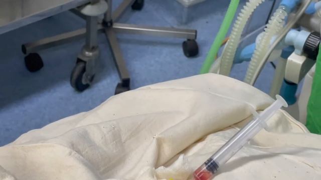 Central Venous Catheter Insertion to a neonate, 1.6Kg weight by Dr Kapila Hettiarachchi in Sri Lank смотреть онлайн