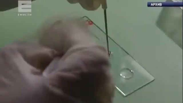 Первые случаи укусов клещей зарегистрированы в Красноярском крае смотреть онлайн