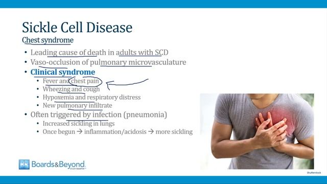 7.Sickle Cell Disease смотреть онлайн