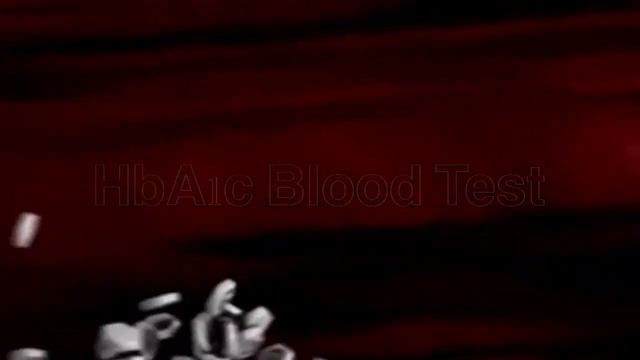 HbA1c Blood Test In Urdu | HbA1c Test for Diabetes | Hemoglobin A1c Test: Normal, Low/High Levels смотреть онлайн