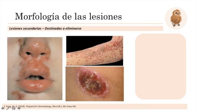 Semiología de la piel смотреть онлайн