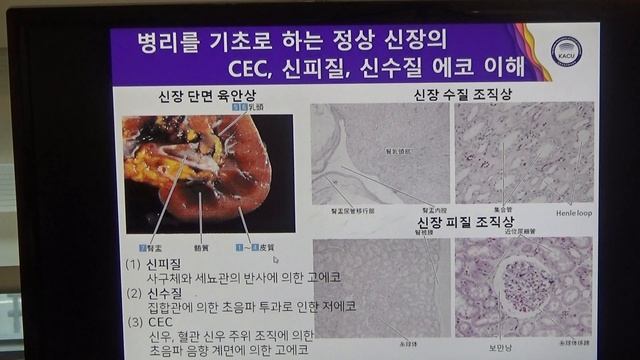 2020년 3월 13일 김일봉 초음파 특강(3)-1 смотреть онлайн