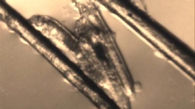Demodex folliculorum смотреть онлайн