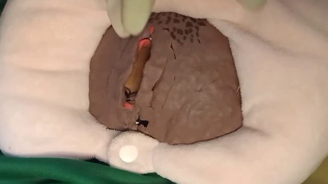 Bimanual Pelvic Examination смотреть онлайн