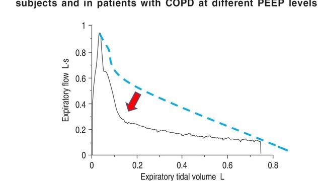 MV in COPD patients. Pesenti Antonio 2017