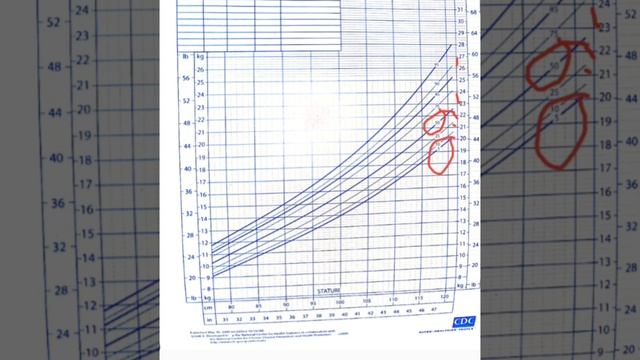 Z Score Calculation । Pediatrics OSPE