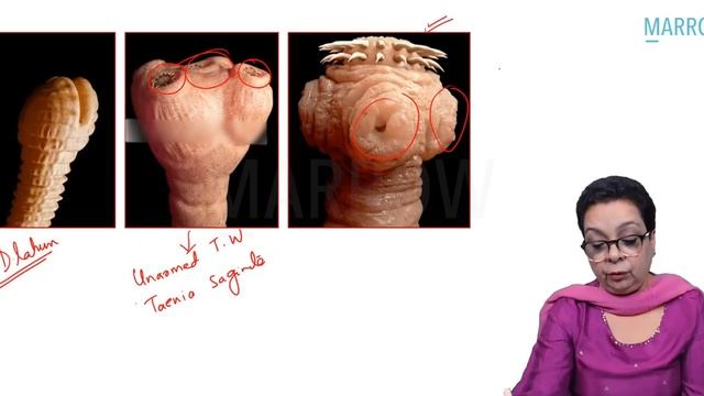 Exam Recall Series (INI CET Nov '22) - Microbiology смотреть онлайн