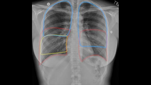 index-5 смотреть онлайн
