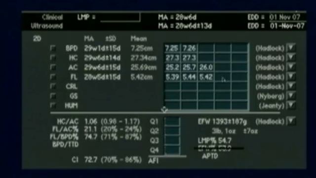 The Standard Antepartum Obstetrical Sonogram AIUM Guidelines Revisited смотреть онлайн
