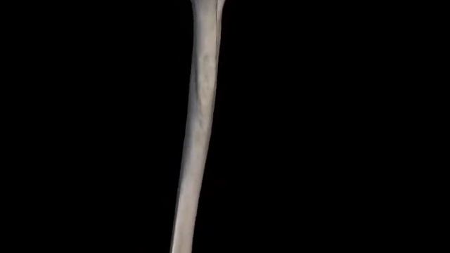 Humerus_iyin súyegi смотреть онлайн