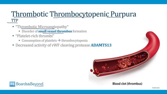9.Thrombocytopenia