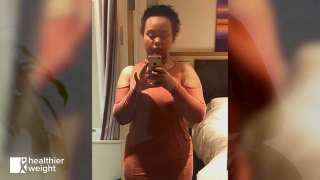 Georgina's Gastric Bypass Story смотреть онлайн