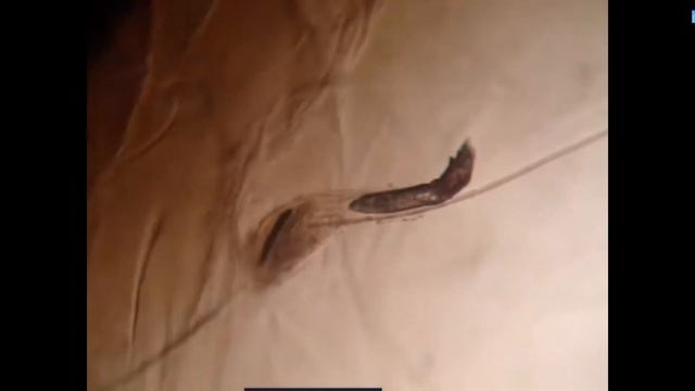 Demodex folliculorum 02 смотреть онлайн