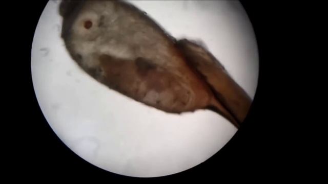 PEDICULUS CAPITIS- Trabalho UDF смотреть онлайн