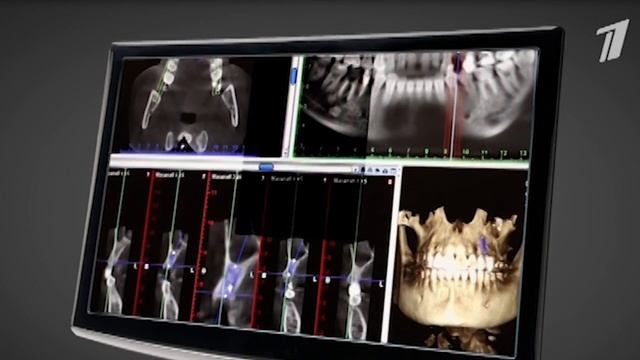 НА 10 ЛЕТ МОЛОЖЕ / Выпуск 20 смотреть онлайн