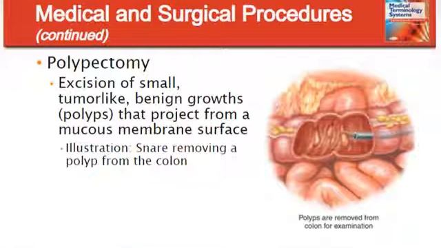 Medical Terminology ; Digstive system by Dr. Susan Zwyea смотреть онлайн