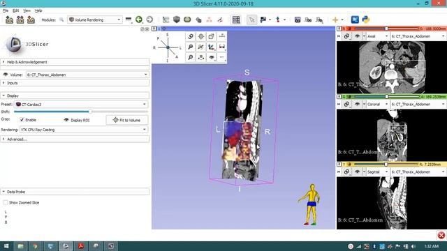3d slicer ASSIGNMENT смотреть онлайн