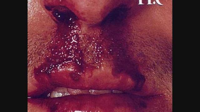 FF.C - Mia Alli Diapistosi смотреть онлайн