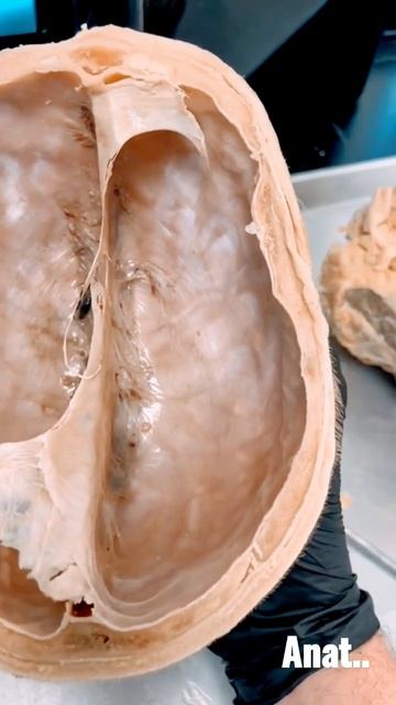 skull with duramatar #anatomy#grasp it #viral #mbbs#neet смотреть онлайн