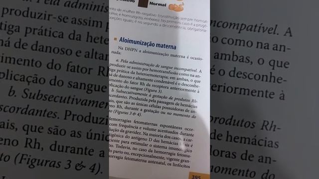 Doença Hemolítica Perinatal / Eritroblastose Fetal смотреть онлайн