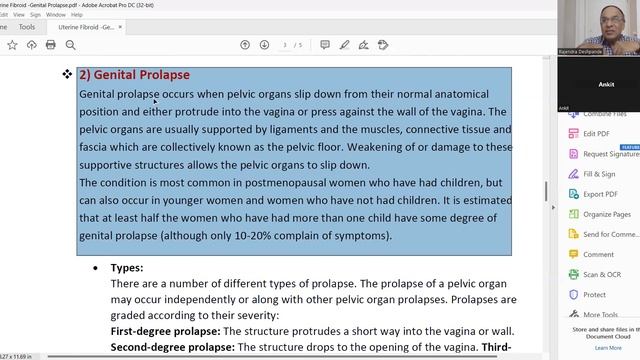 Uterine fibroid l Genital prolapse l causes l symptoms l treatment l #Gynaecology #bamslectures смотреть онлайн